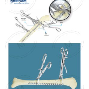 2. 创伤系列产品图册 Trauma 55 1
